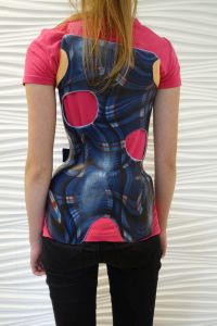 Gorsety do leczenia skolioz