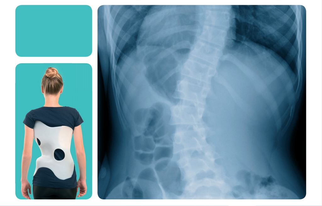 Gorsety ortopedyczne