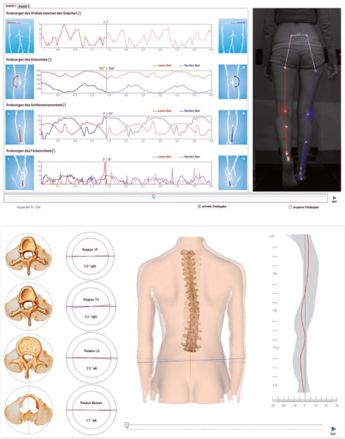 Jak przeprowadzane jest badanie?